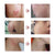 Acne Scar Remover Cream